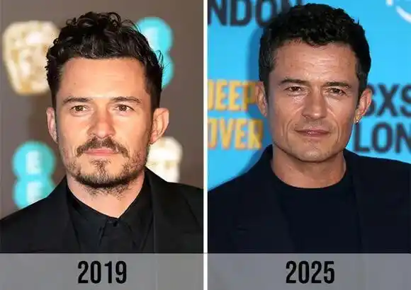 Orlando Bloom Orlando Bloom